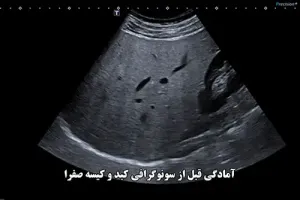 آمادگی قبل از سونوگرافی کبد و کیسه صفرا